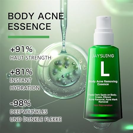 Body Pimple Repair Moisturizer (30ml) - 𝕒𝕝 𝕥𝕒𝕨𝕗𝕚𝕢