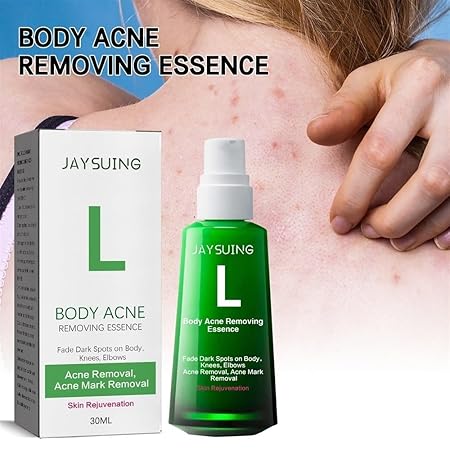 Body Pimple Repair Moisturizer (30ml) - 𝕒𝕝 𝕥𝕒𝕨𝕗𝕚𝕢
