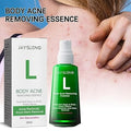Body Pimple Repair Moisturizer (30ml) - 𝕒𝕝 𝕥𝕒𝕨𝕗𝕚𝕢